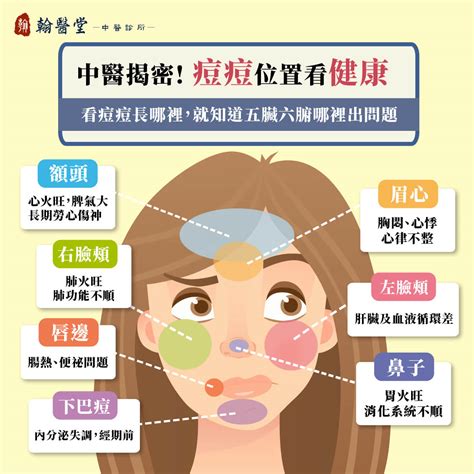 痘痘 臉|青春痘、下巴痘痘長這個位置代表什麼意思？先弄懂長。